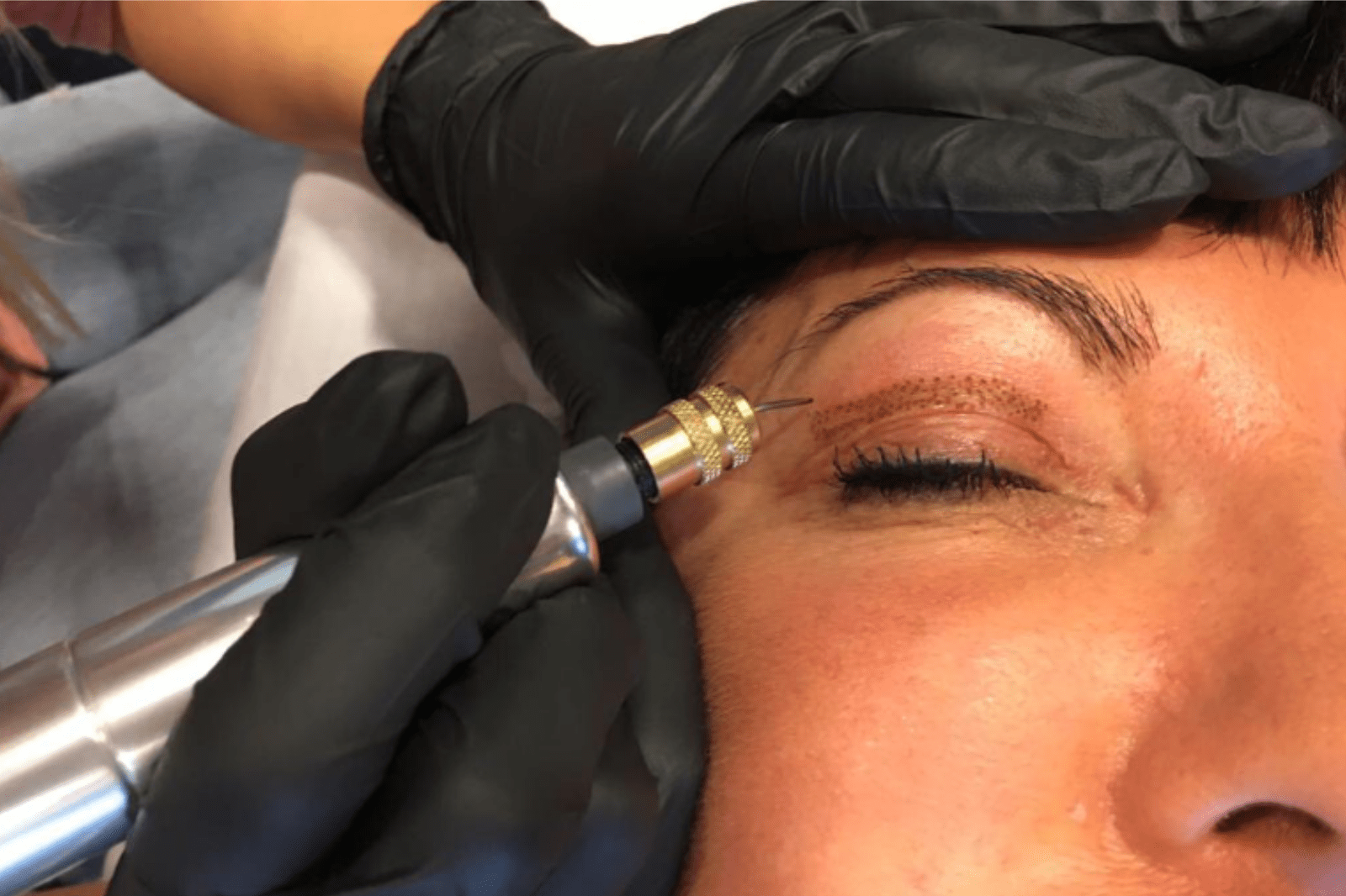 Eine Frau in einer Plasmapenbehandlung